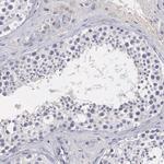NREP Antibody in Immunohistochemistry (Paraffin) (IHC (P))
