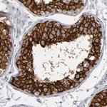 KIAA1210 Polyclonal Antibody