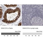 KIAA1210 Antibody in Immunohistochemistry (IHC)