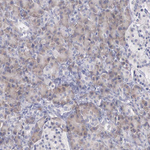 REPS2 Polyclonal Antibody