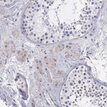 REPS2 Antibody in Immunohistochemistry (Paraffin) (IHC (P))
