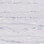 REPS2 Antibody in Immunohistochemistry (Paraffin) (IHC (P))