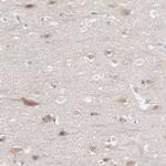 REPS2 Antibody in Immunohistochemistry (IHC)