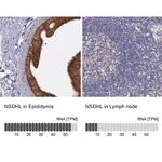 NSDHL Antibody in Immunohistochemistry (IHC)