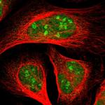 PJA Polyclonal Antibody