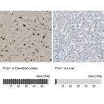 PJA Antibody in Immunohistochemistry (IHC)