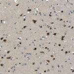 PJA Antibody in Immunohistochemistry (IHC)