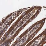 DHRS1 Antibody in Immunohistochemistry (Paraffin) (IHC (P))