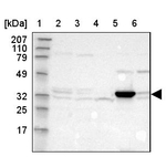 DHRS1 Antibody in Western Blot (WB)