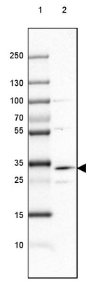 DHRS1 Antibody in Western Blot (WB)