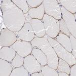 C22orf31 Antibody in Immunohistochemistry (Paraffin) (IHC (P))