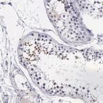 FAM47A Polyclonal Antibody