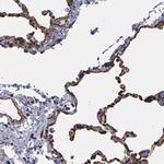 MAGEB10 Polyclonal Antibody