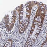 APOOL Antibody in Immunohistochemistry (IHC)