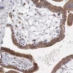 APOOL Antibody in Immunohistochemistry (IHC)