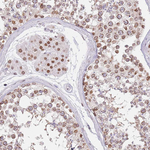 KLHDC2 Antibody in Immunohistochemistry (Paraffin) (IHC (P))