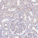 KLHDC2 Antibody in Immunohistochemistry (Paraffin) (IHC (P))