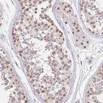 KLHDC2 Antibody in Immunohistochemistry (IHC)