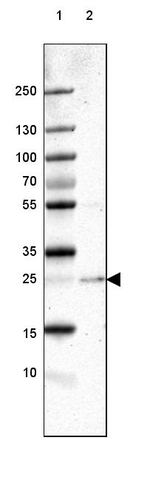 PABPN1 Antibody in Western Blot (WB)