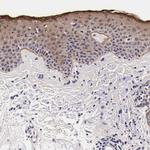 FAM109B Polyclonal Antibody