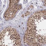 NAGA Polyclonal Antibody