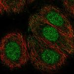 TECPR2 Polyclonal Antibody