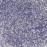 TECPR2 Antibody in Immunohistochemistry (Paraffin) (IHC (P))