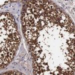TECPR2 Antibody in Immunohistochemistry (Paraffin) (IHC (P))
