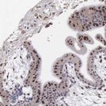 SLC25A21 Polyclonal Antibody