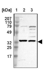 SLC25A21 Antibody in Western Blot (WB)