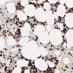FCN1 Antibody in Immunohistochemistry (Paraffin) (IHC (P))