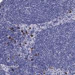 FCN1 Antibody in Immunohistochemistry (Paraffin) (IHC (P))