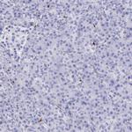 FCN1 Antibody in Immunohistochemistry (Paraffin) (IHC (P))