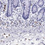 FCN1 Antibody in Immunohistochemistry (Paraffin) (IHC (P))