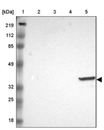 FCN1 Antibody in Western Blot (WB)