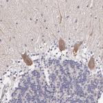 NINL Antibody in Immunohistochemistry (Paraffin) (IHC (P))