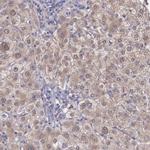 NINL Antibody in Immunohistochemistry (Paraffin) (IHC (P))