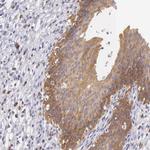 OSBPL3 Antibody in Immunohistochemistry (Paraffin) (IHC (P))