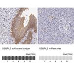 OSBPL3 Antibody in Immunohistochemistry (IHC)