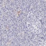OSBPL3 Antibody in Immunohistochemistry (IHC)