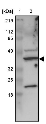 C22orf29 Antibody in Western Blot (WB)