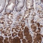 INF2 Antibody in Immunohistochemistry (IHC)