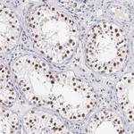 HMGXB4 Antibody in Immunohistochemistry (Paraffin) (IHC (P))