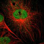 SPIN3 Polyclonal Antibody