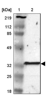 GSTT2B Antibody in Western Blot (WB)