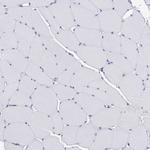 Serglycin Antibody in Immunohistochemistry (Paraffin) (IHC (P))