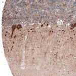 ACOT4 Polyclonal Antibody