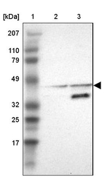 ACOT4 Antibody in Western Blot (WB)