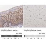 CKAP4 Antibody in Immunohistochemistry (IHC)