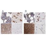 CKAP4 Antibody in Immunohistochemistry (IHC)